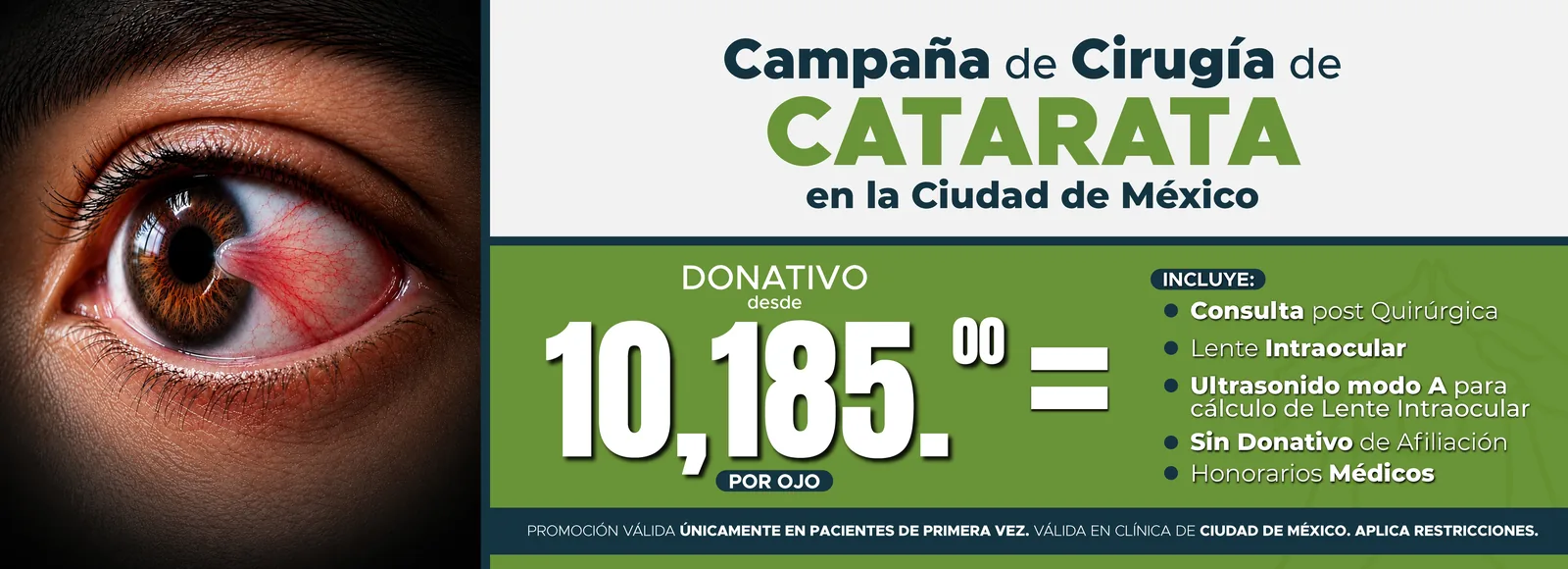 Campaña de cirugía de catarata en la Ciudad de México. Donativo desde $10,185 por ojo. Incluye consulta posquirúrgica, lente intraocular, ultrasonido modo A, sin donativo de afiliación y honorarios médicos. Solo pacientes de primera vez.