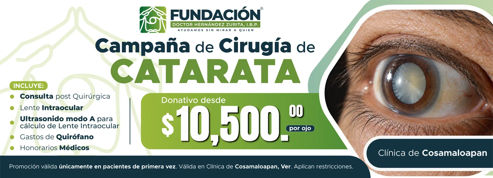 Campaña de cirugía de catarata en la clínica de Cosamaloapan, Veracruz. Donativo desde $10,500 por ojo. Incluye consulta posquirúrgica, lente intraocular, ultrasonido modo A, gastos de quirófano y honorarios médicos. Solo pacientes de primera vez.