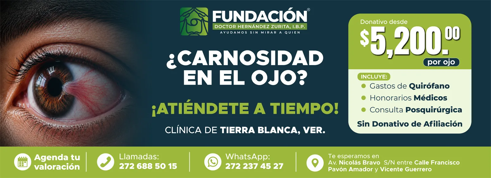 ¿Tienes cataratas? Opérate ya en la clínica de Tierra Blanca, Veracruz. Donativo desde $10,500 por ojo. Llamadas 272 688 50 15, WhatsApp 272 237 45 27. Av. Nicolás Bravo S/N entre Francisco Pavón Amador y Vicente Guerrero.