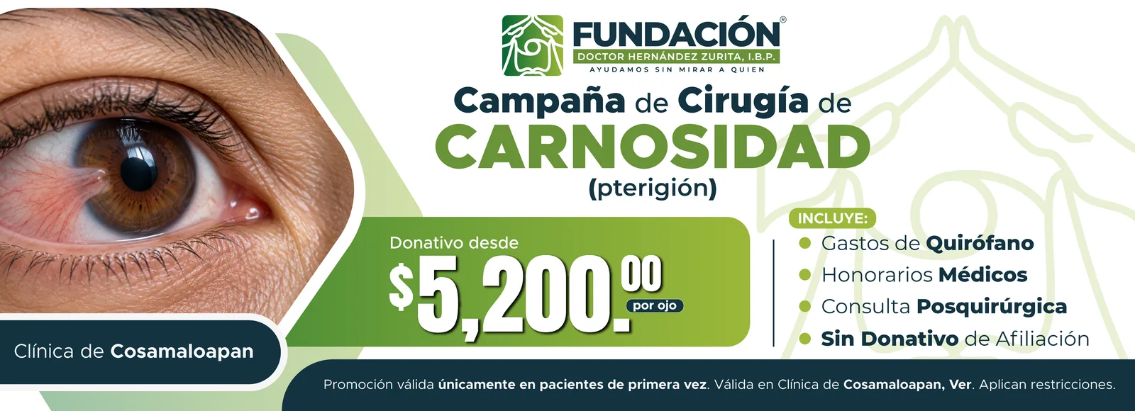 Campaña de cirugía de carnosidad (pterigión) en la clínica de Cosamaloapan, Veracruz. Donativo desde $5,200 por ojo. Incluye gastos de quirófano, honorarios médicos, consulta posquirúrgica y sin donativo de afiliación. Solo pacientes de primera vez.