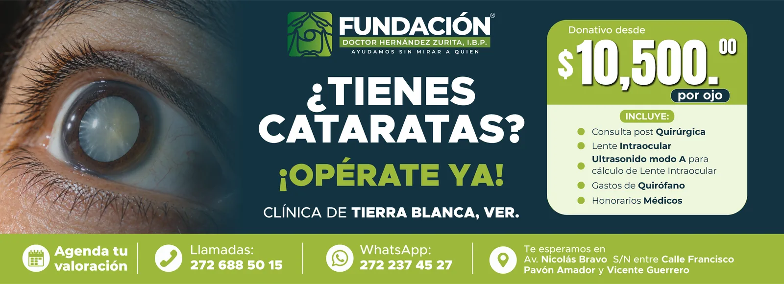 ¿Carnosidad en el ojo? Atiéndete a tiempo en la clínica de Tierra Blanca, Veracruz. Donativo desde $5,200 por ojo. Llamadas 272 688 50 15, WhatsApp 272 237 45 27.
